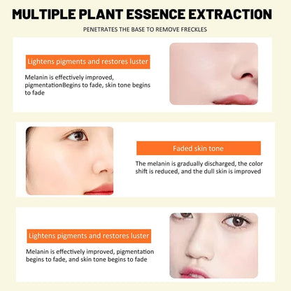 Fivfivgo® TripleAction Vitamin C Freckle Removal Cream