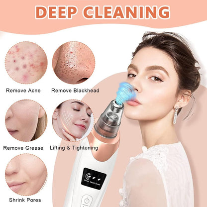 Electric Blackhead Remover Vacuum – Pore Cleaner with Multi-Level Suction