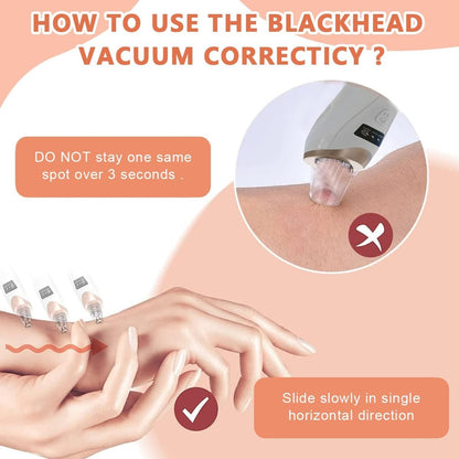 Electric Blackhead Remover Vacuum – Pore Cleaner with Multi-Level Suction