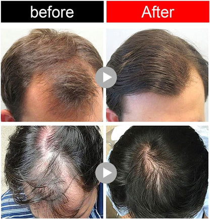 Ceoerty™ HGrow Rice Water Hair Essence: