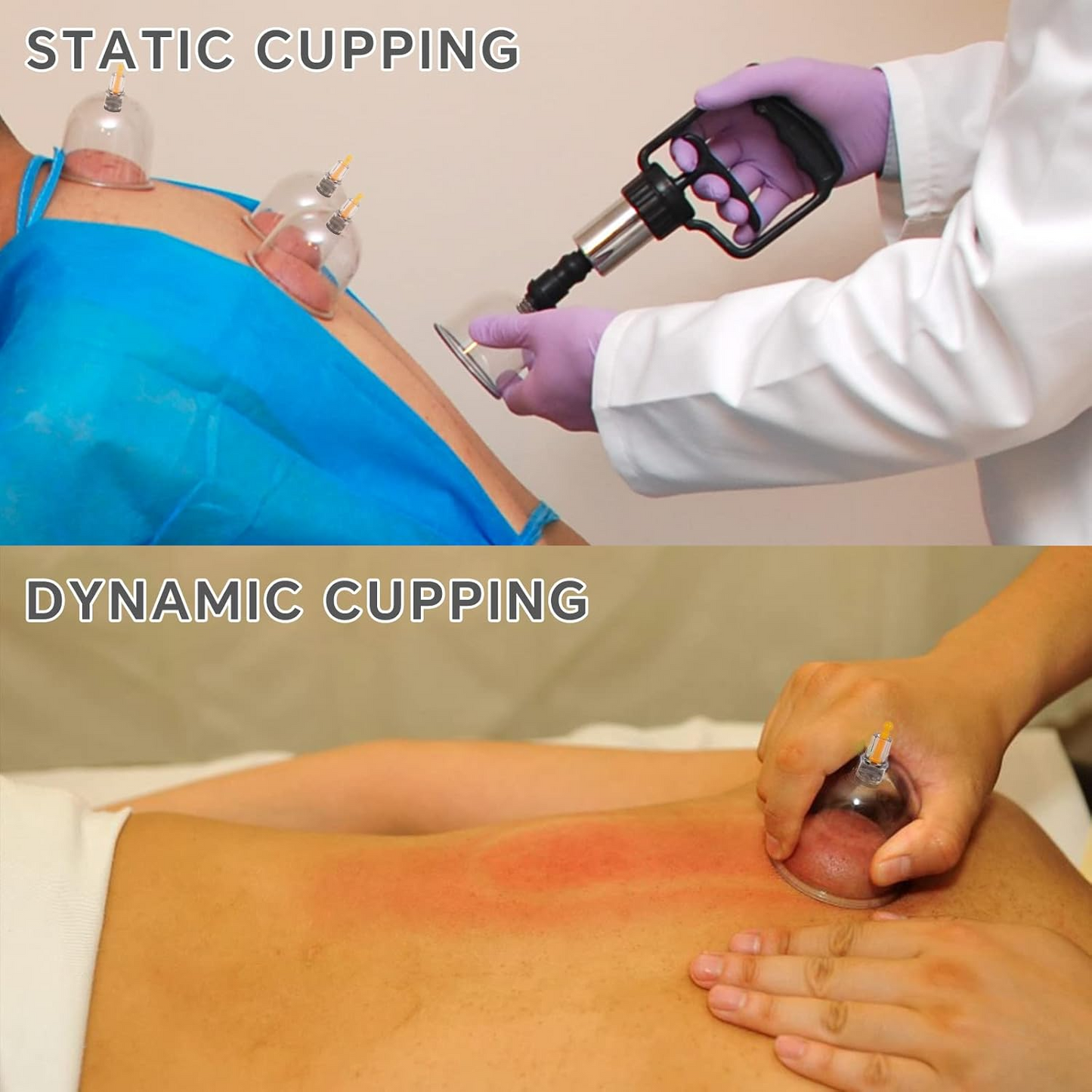 Professional Cupping Therapy Set – 12 Cup Massage & Recovery Kit