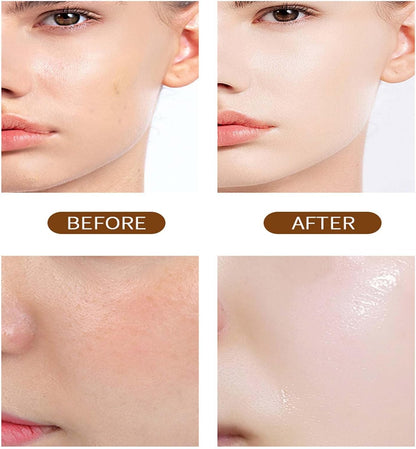 NIACINAMIDE Pure Serum