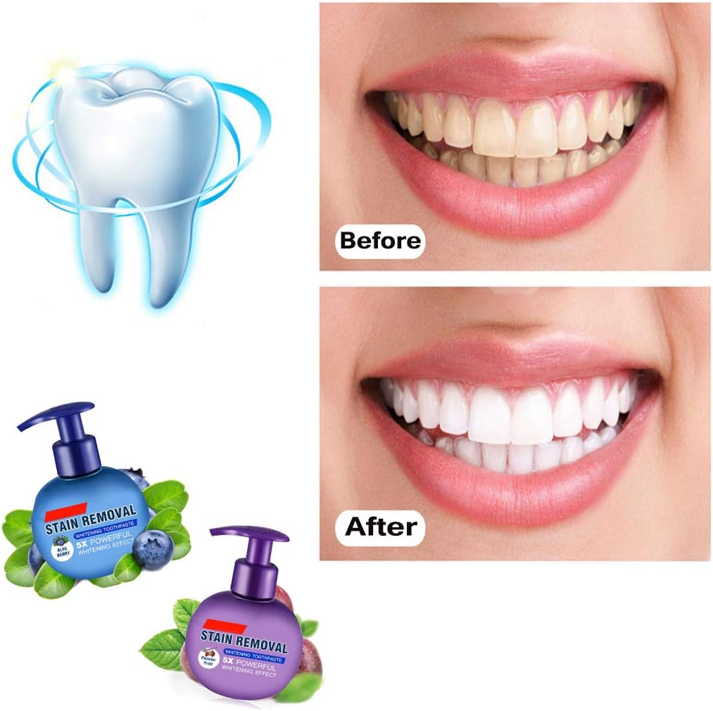 Intensive Stain Removal Whitening Toothpaste