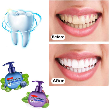 Intensive Stain Removal Whitening Toothpaste
