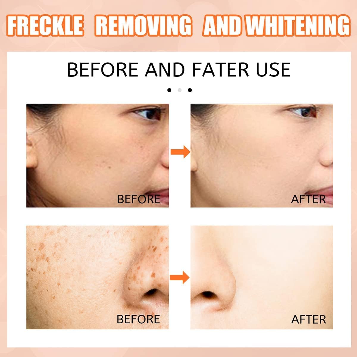 Fivfivgo® TripleAction Vitamin C Freckle Removal Cream