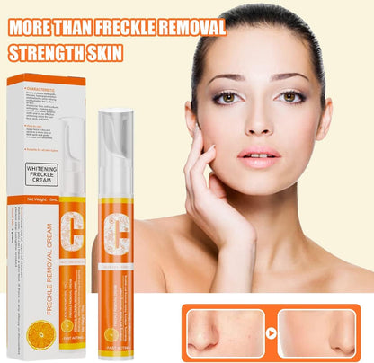 Fivfivgo® TripleAction Vitamin C Freckle Removal Cream