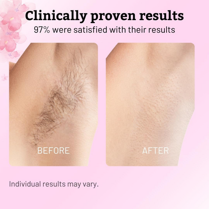 Cyprus Rotundus Hair Removal Care Oil – Gentle Skin Moisturizing & Daily Care Formula