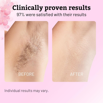 Cyperus Hair Removal Care Oil  Moisturizing for Smooth Skin