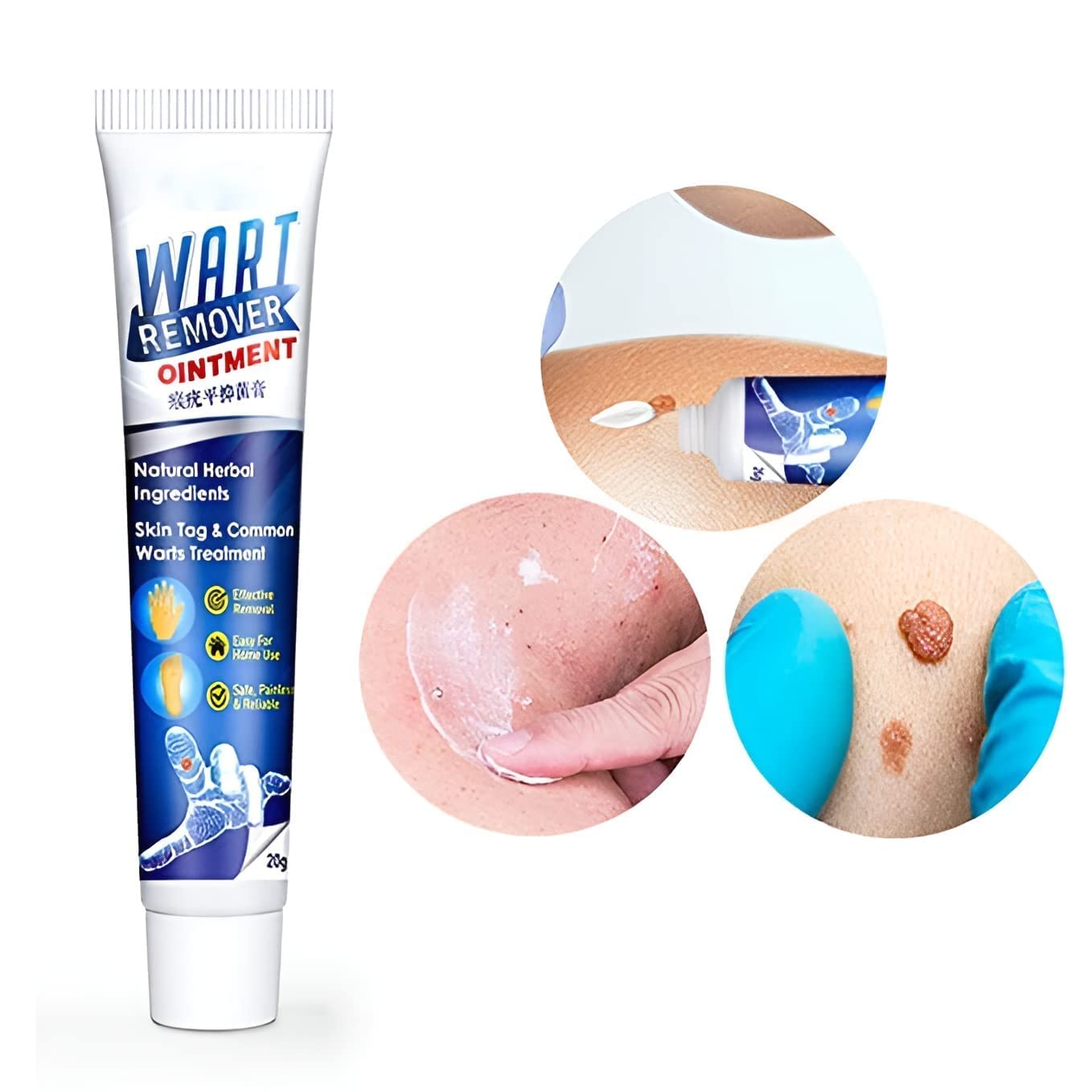Wart Instant Blemish Cream