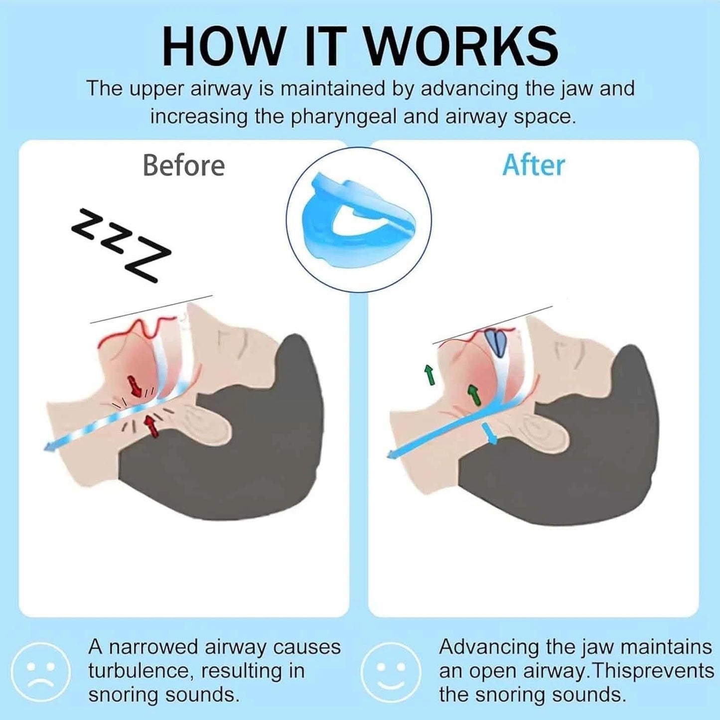 Anti-Snoring Mouthpiece – Sleep Aid Mouth Guard for Quiet Nights