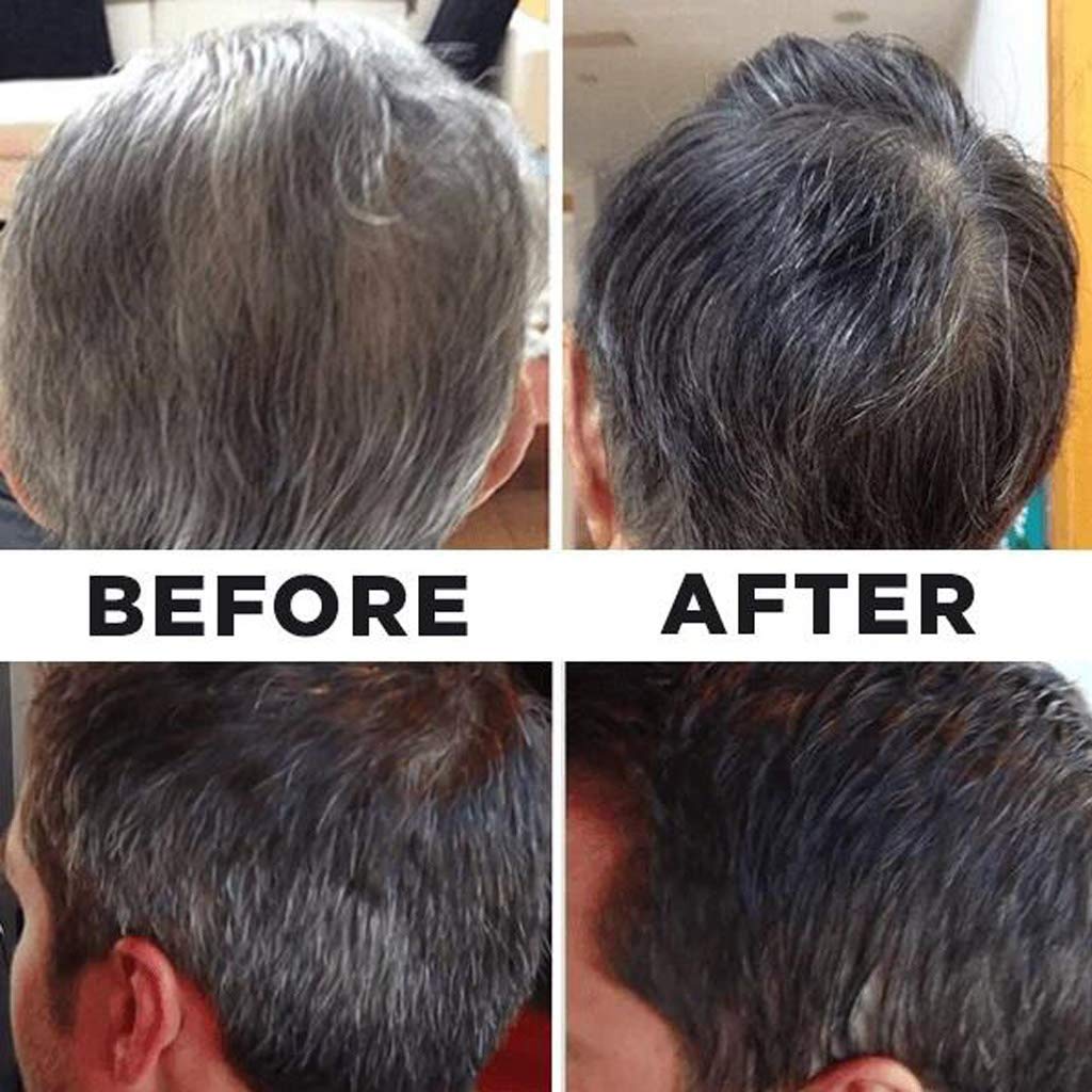 Tivfivgo™ GrayAway Sofort-Wurzel-Dauer-Spray
