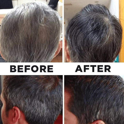 Tivfivgo™ GrayAway Sofort-Wurzel-Dauer-Spray