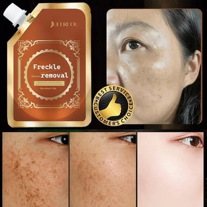 2025 New Anti-Blemish & Anti-Aging Tear-Off Mask (Clinically Certified)