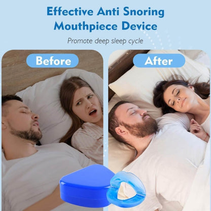 Anti-Snoring Mouthpiece – Sleep Aid Mouth Guard for Quiet Nights