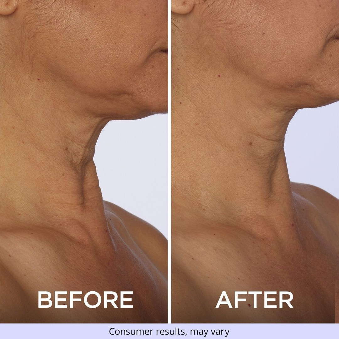 Collagen Neck Firming Cream – Lifting & Anti-Wrinkle Care