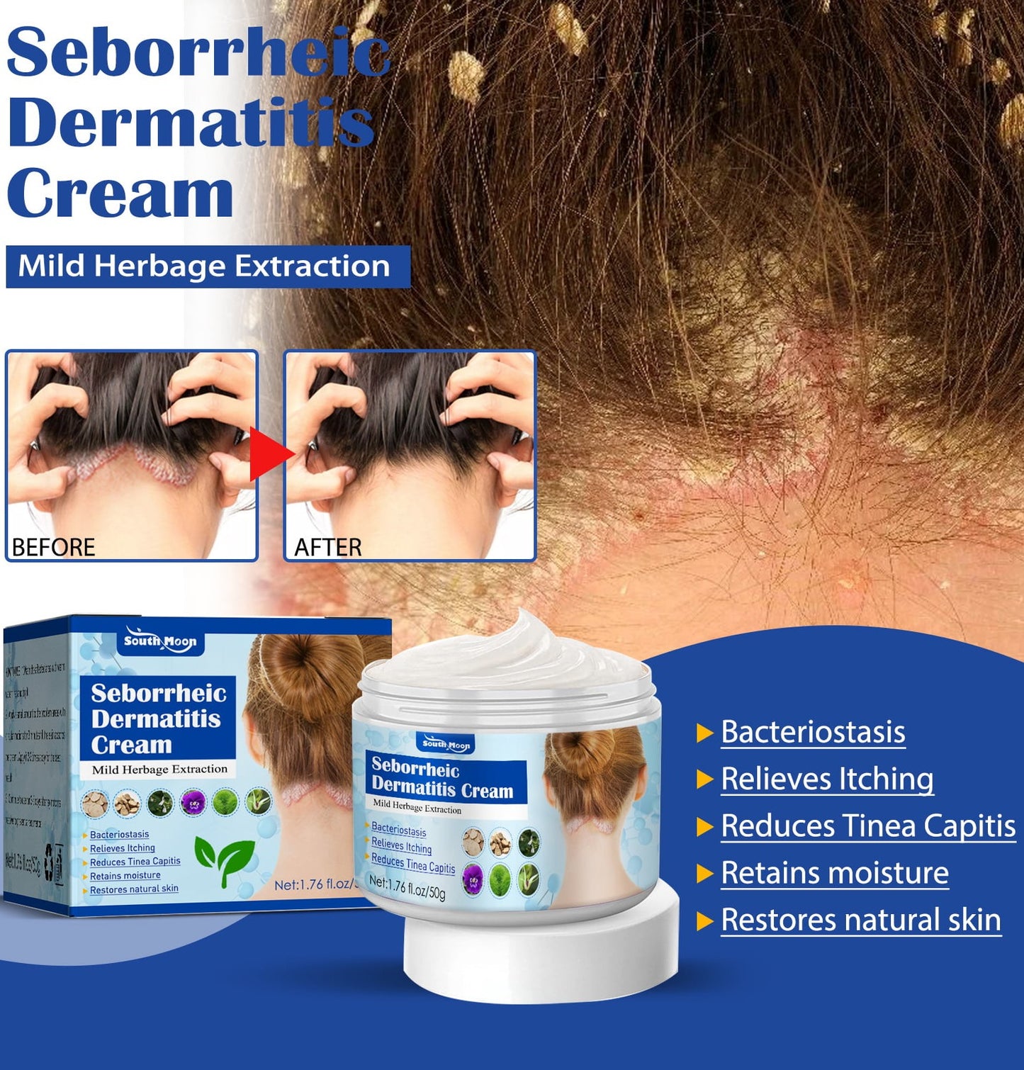 EMeds™ Seborrheic Dermatitis Cream