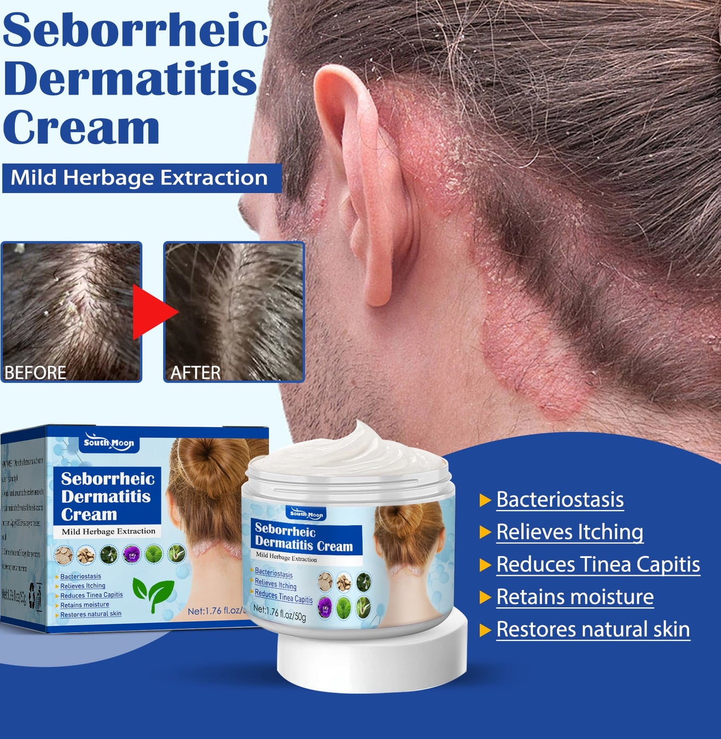 EMeds™ Seborrheic Dermatitis Cream