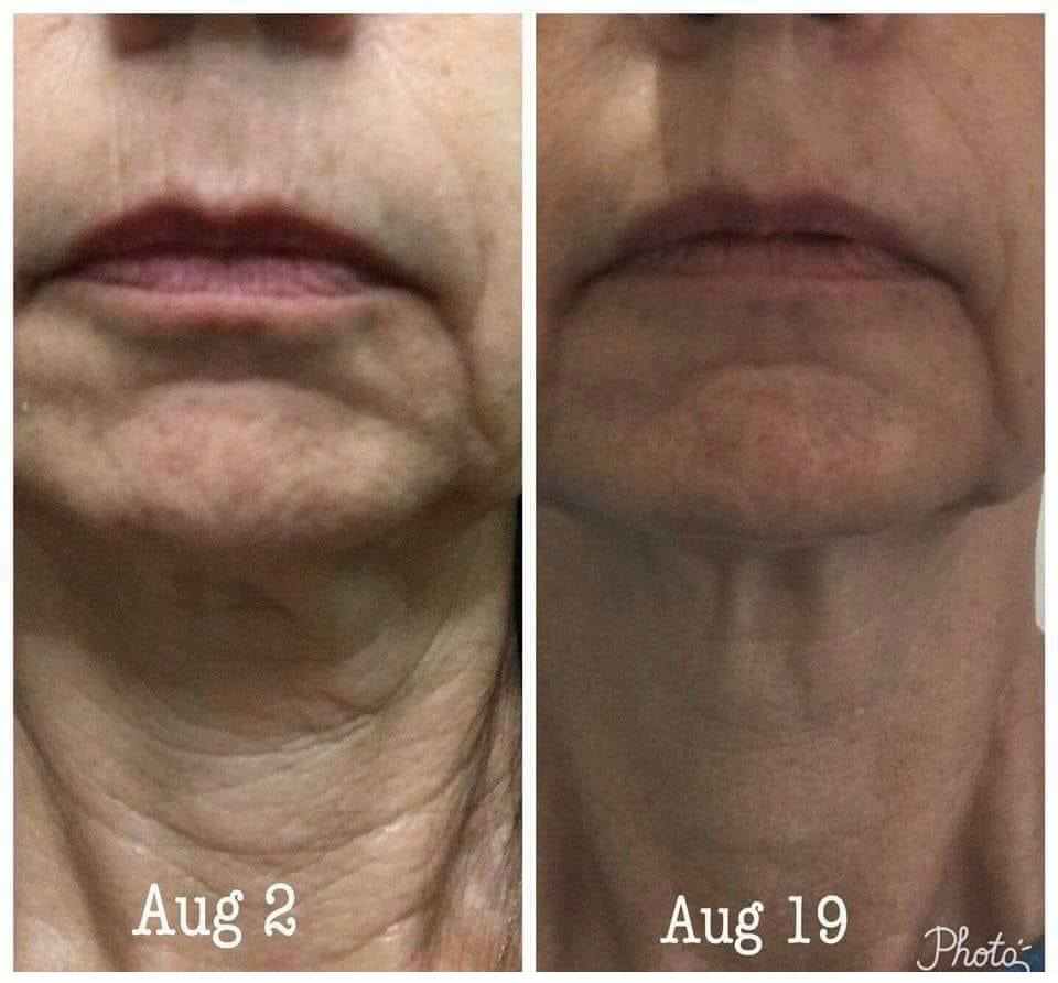 Retinol Body Lotion – Firm, Smooth & Youthful Skin Care