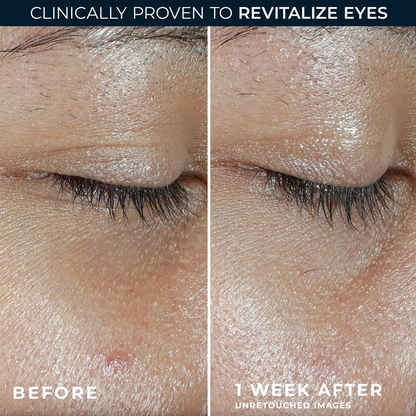 Vitamin C Eye Cream Stick – Brighten, Firm & Smooth Eye Care