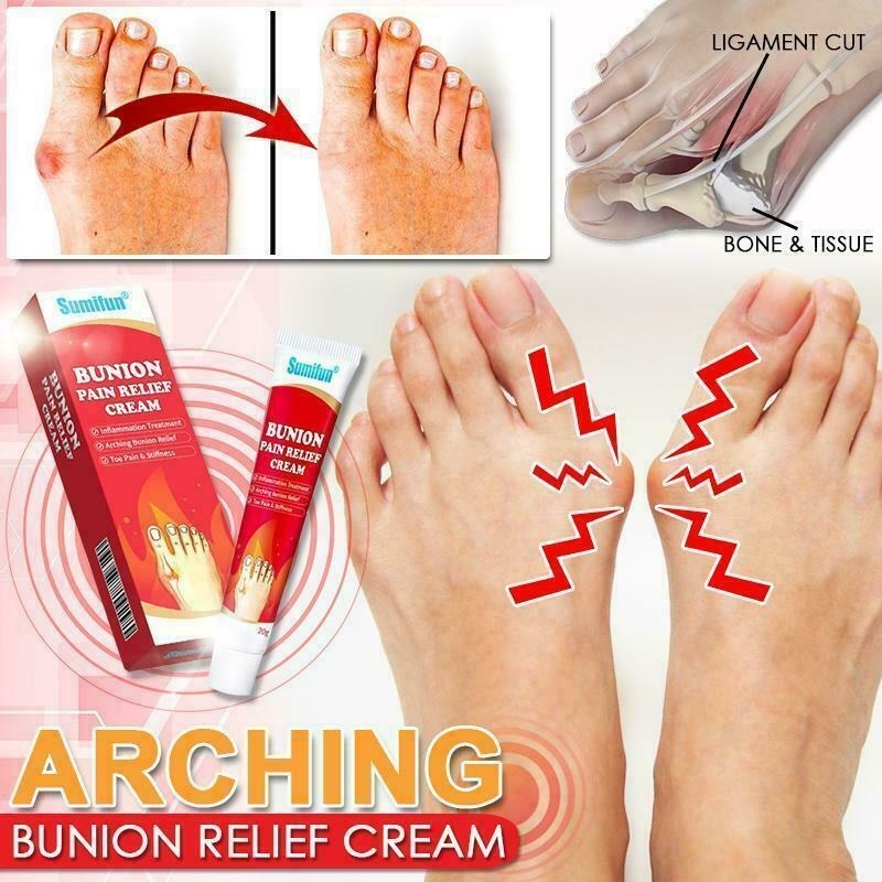 Bunion Pain Relief Cream – Soothing Herbal Comfort for Achy Feet