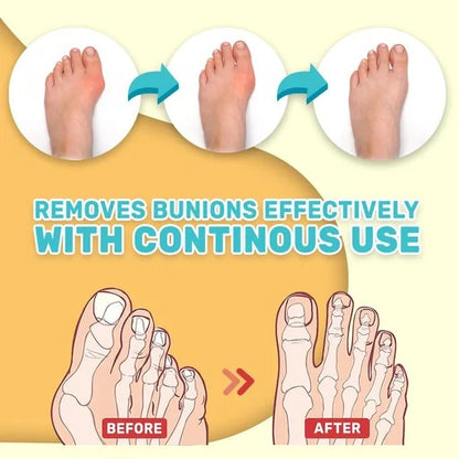 Bunion Pain Relief Cream – Soothing Herbal Comfort for Achy Feet