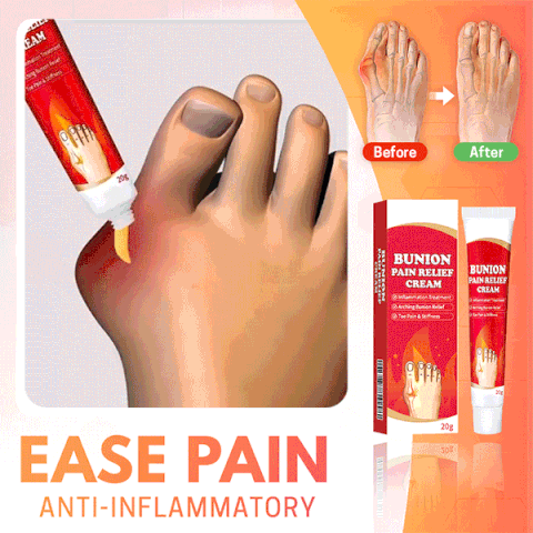 Bunion Pain Relief Cream – Soothing Herbal Comfort for Achy Feet