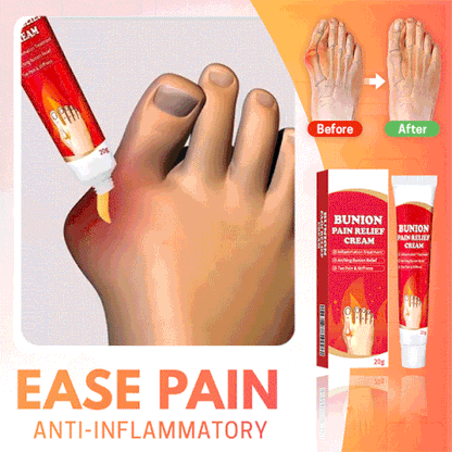 Bunion Pain Relief Cream – Soothing Herbal Comfort for Achy Feet