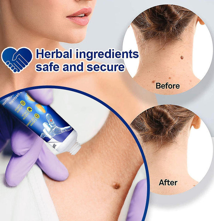 Wart Instant Blemish Cream