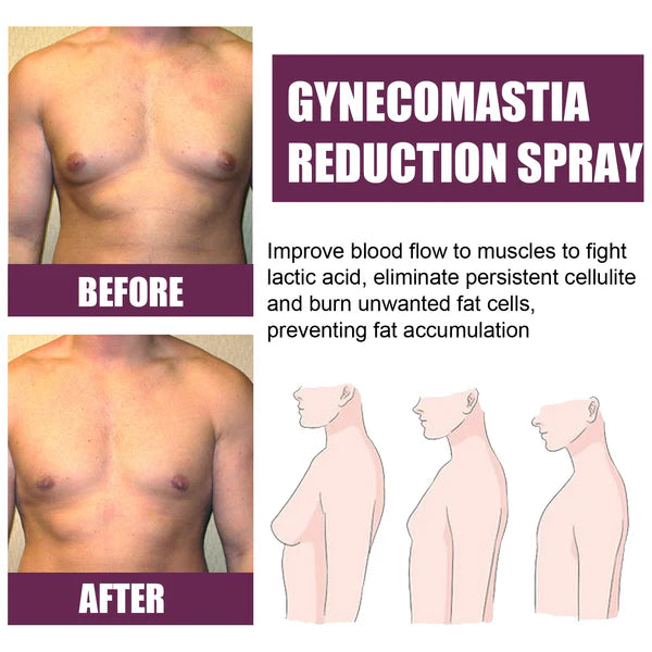 Gynecomastia Reduction Spray: