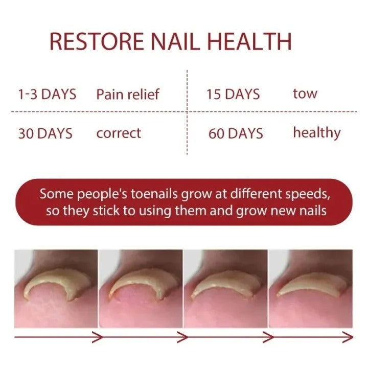Relief Nail Oil – Extra Strength Care for Discolored & Damaged Nails