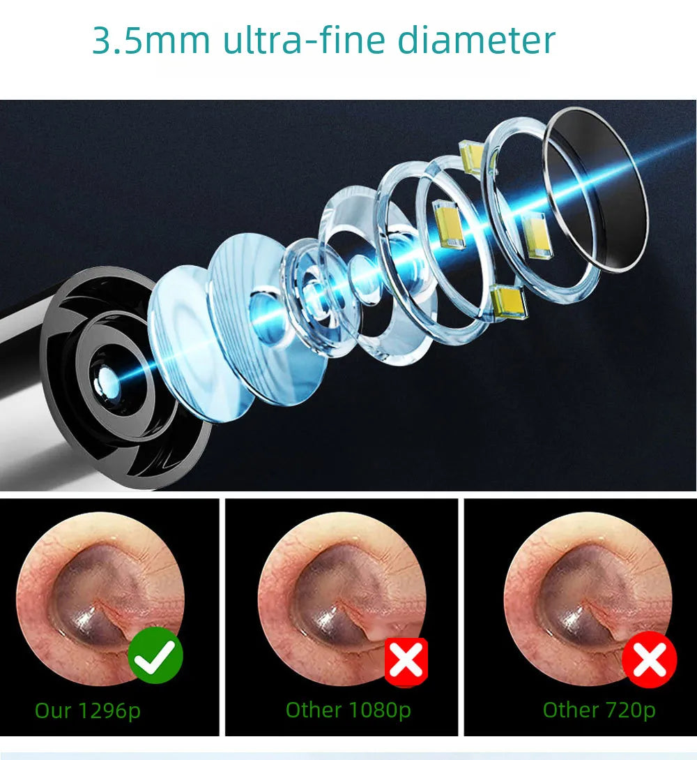 Visual Electric Ear Wax Removal Tool