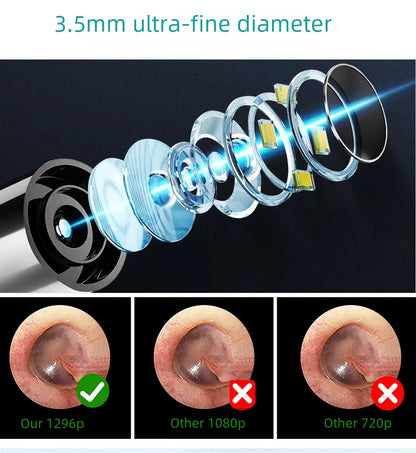 Visual Electric Ear Wax Removal Tool