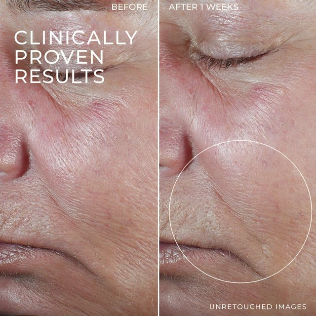 Retinol Firming Serum Bars – Anti-Aging Face & Neck Care Treatment
