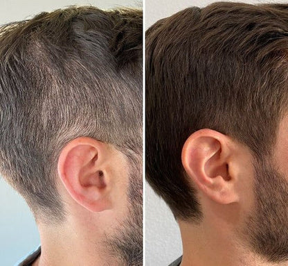 Fivfivgo™ anti-hair loss spray