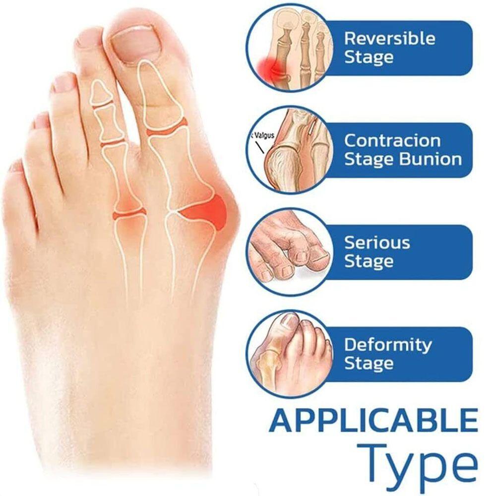 Bunion Relief Socks Realign & Soothe Feet Naturally