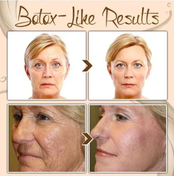 Polypeptide Face Cream – Lift, Smooth, and Glow in 2 Weeks
