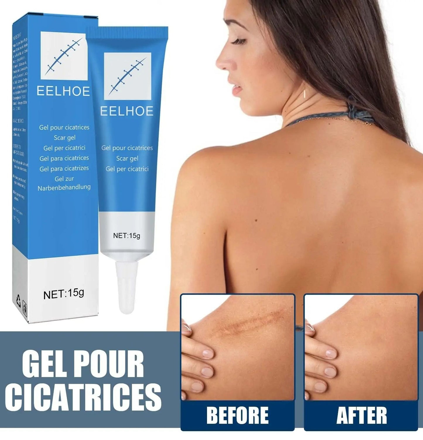 Organic Scar Removal Cream