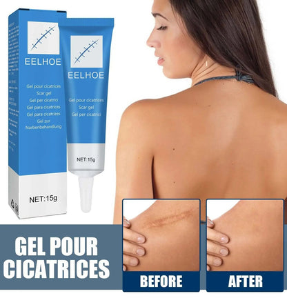 Organic Scar Removal Cream