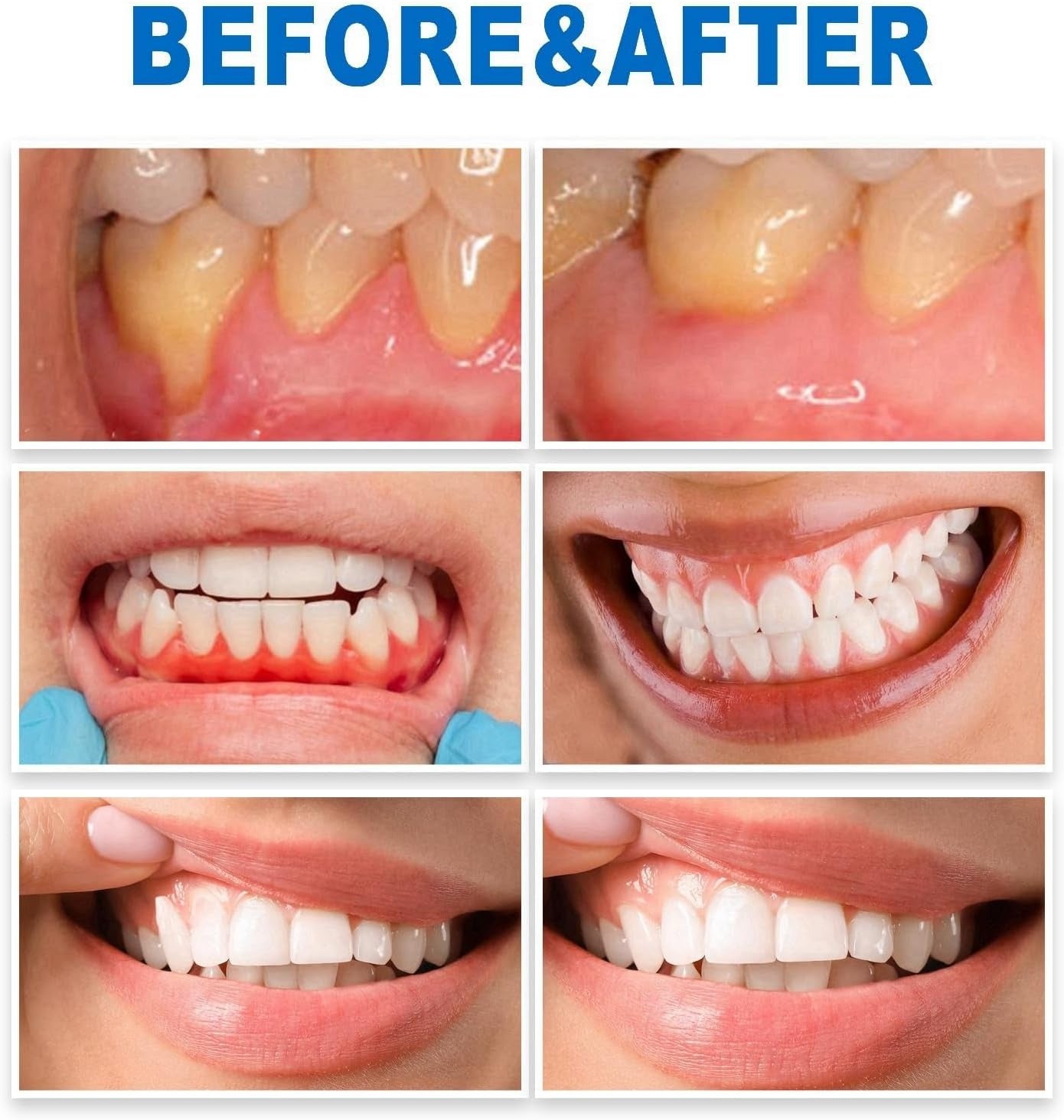 Herbal Toothache Relief Spray – Natural Oral Care for Gum & Teeth Comfort