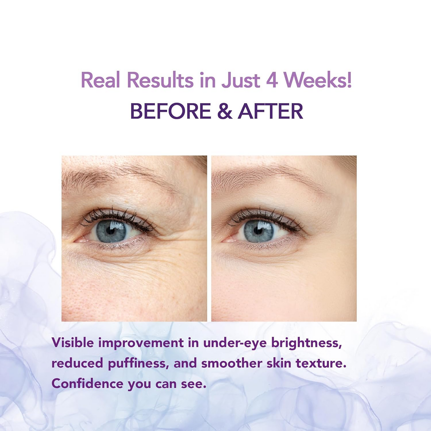 Korean Calcium Bonding Eye Cream – Firm, Bright & Youthful Eyes