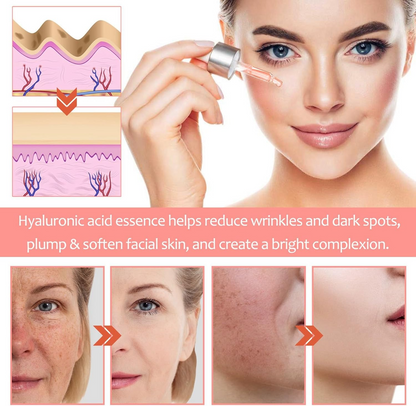 5-in-1 Hyaluronic Acid & Vitamin C Facial Serum