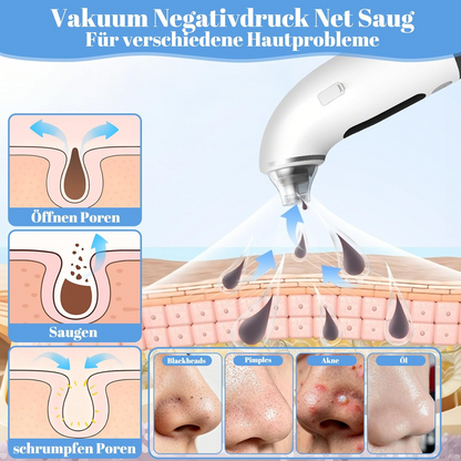 Portable LED Rechargeable Blackhead Remover