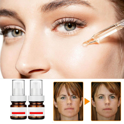 Vitamin C Cream – Brighten, Fade Dark Spots