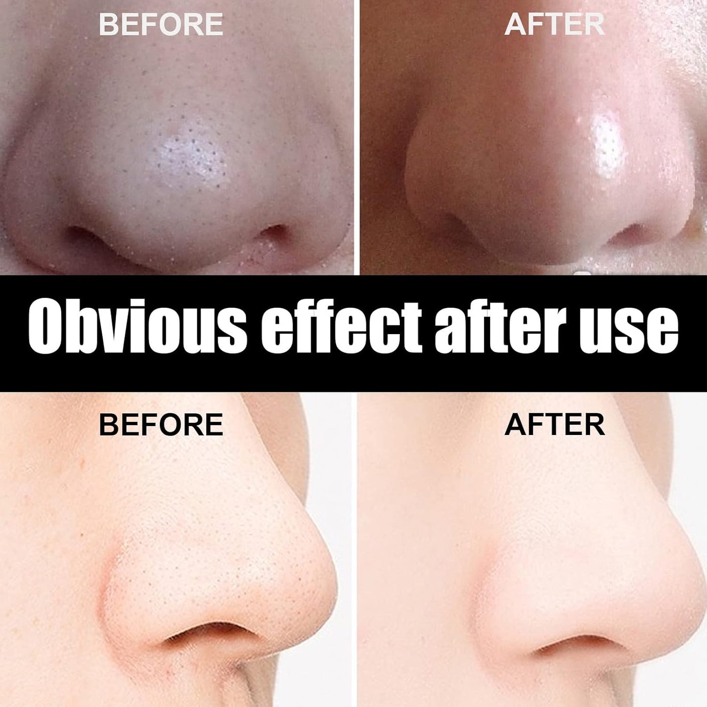 Green Tea Nose Mask – Peel-Off Blackhead Remover &amp; Pore Tightener