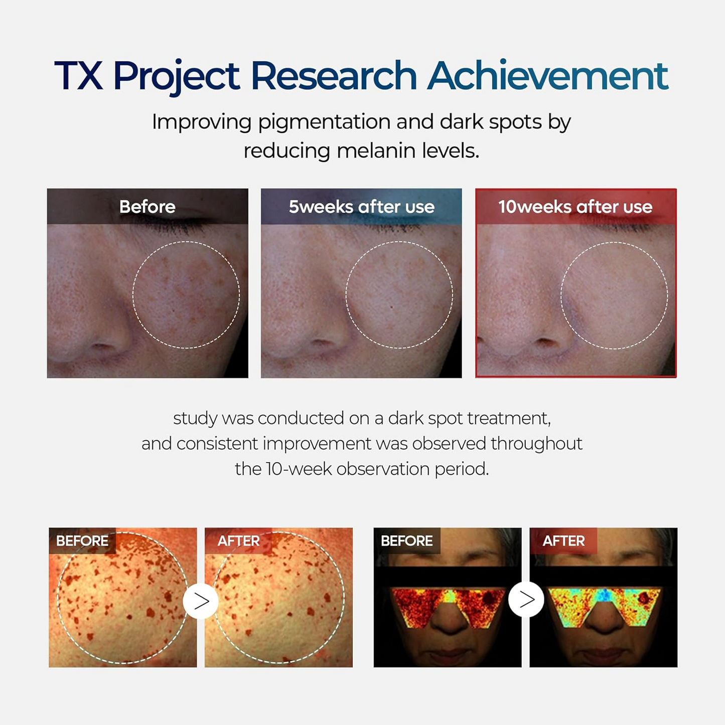 TX Skin Freckle Cream – Korean Dark Spot & Hyperpigmentation Care
