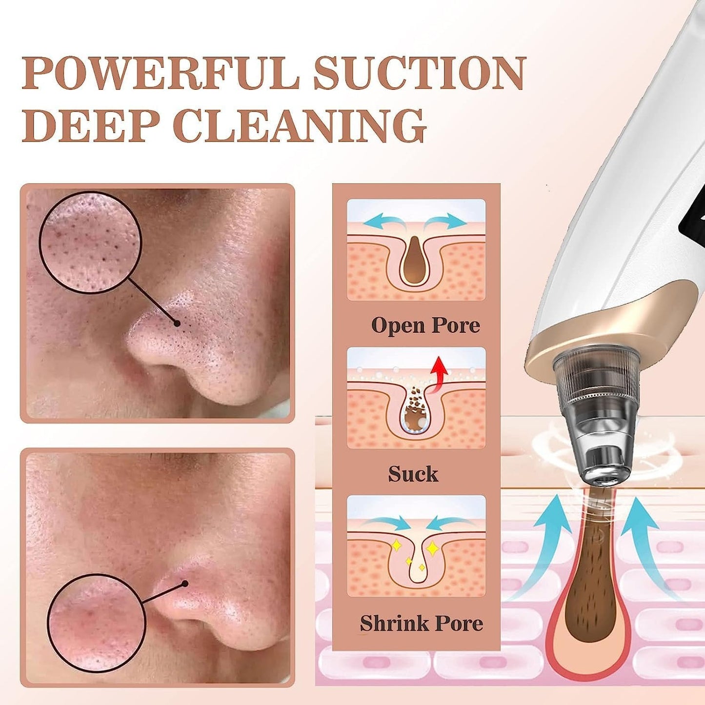 Electric Blackhead Remover Vacuum – Pore Cleaner with Multi-Level Suction