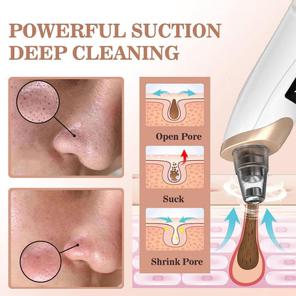 Electric Blackhead Remover Vacuum – Pore Cleaner with Multi-Level Suction