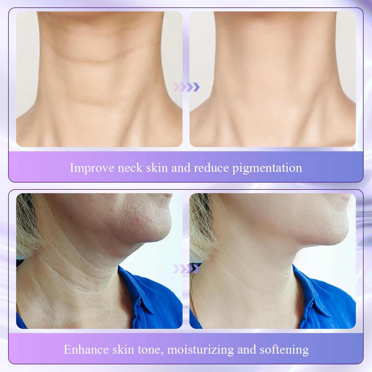 Collagen Neck Firming Cream – Lifting & Anti-Wrinkle Care