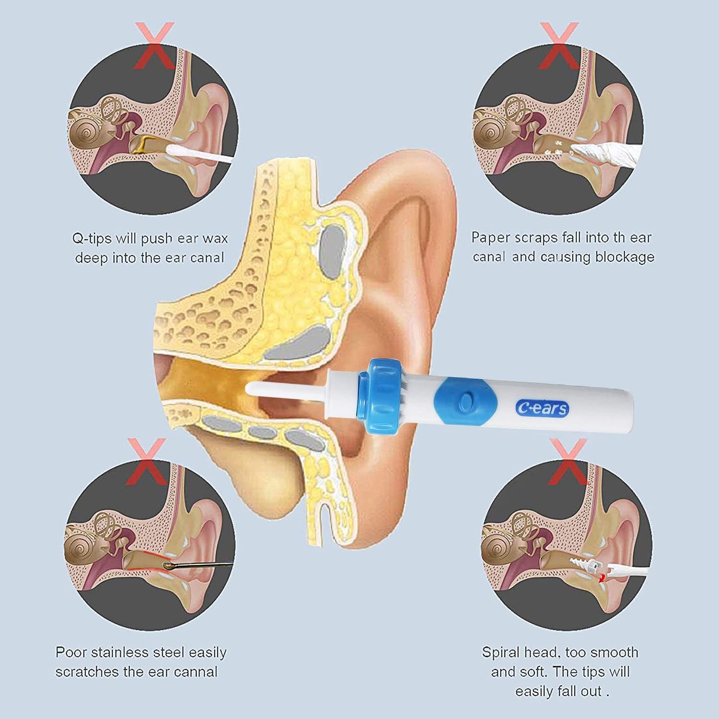 Electric Ear Cleaner Vacuum – Safe & Painless Earwax Removal Tool