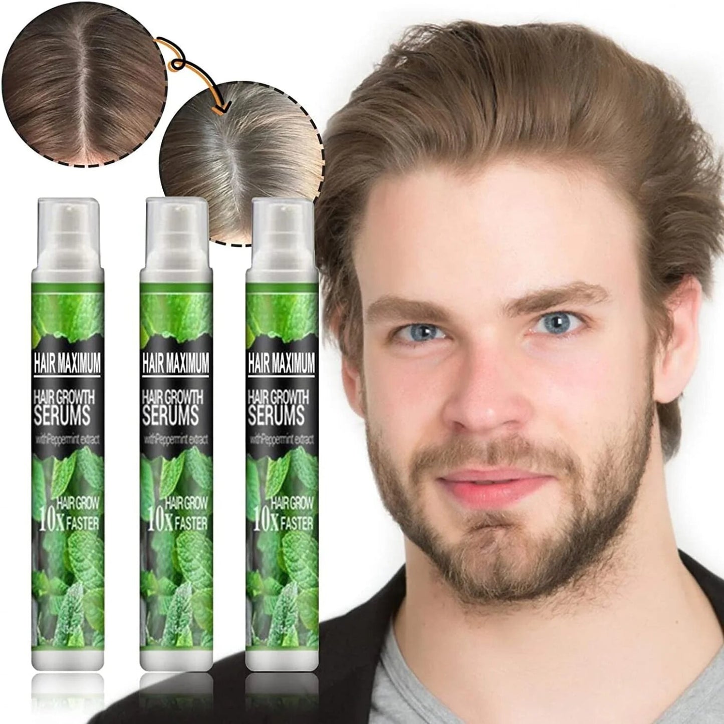 HairRebirth herbal spray (3 pieces)